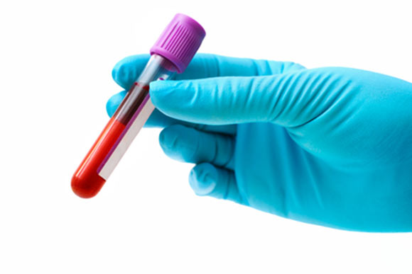 New blood test for cancer.