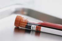 Tube containing a blood sample