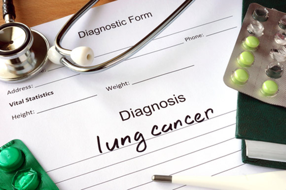 Incidence of Lung Cancer in Non-Smokers Rises To 15%